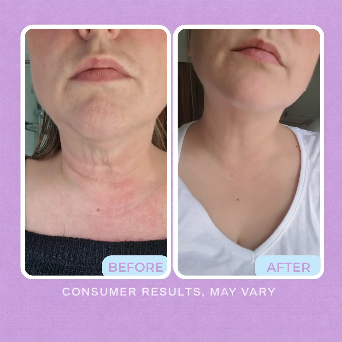 Tighten & Lift Neck Cream